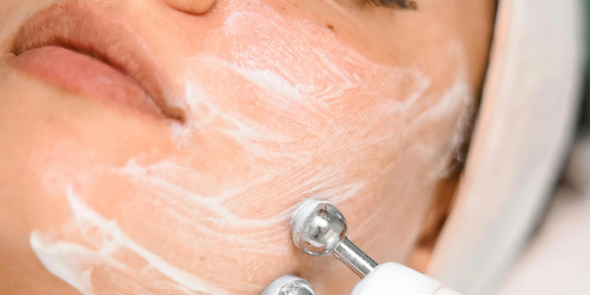 Siyah Nokta Nedir ve Nasıl Temizlenir?